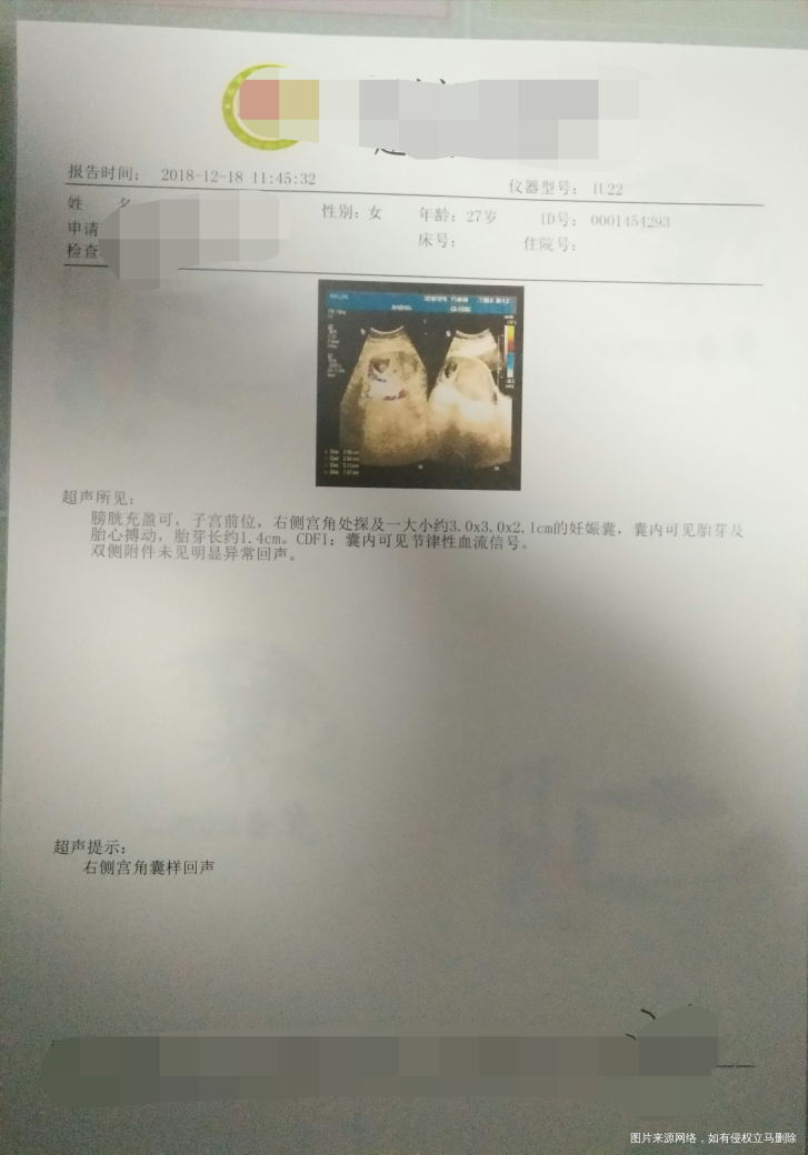 右侧宫角妊娠,想保住孩子,希望大吗?