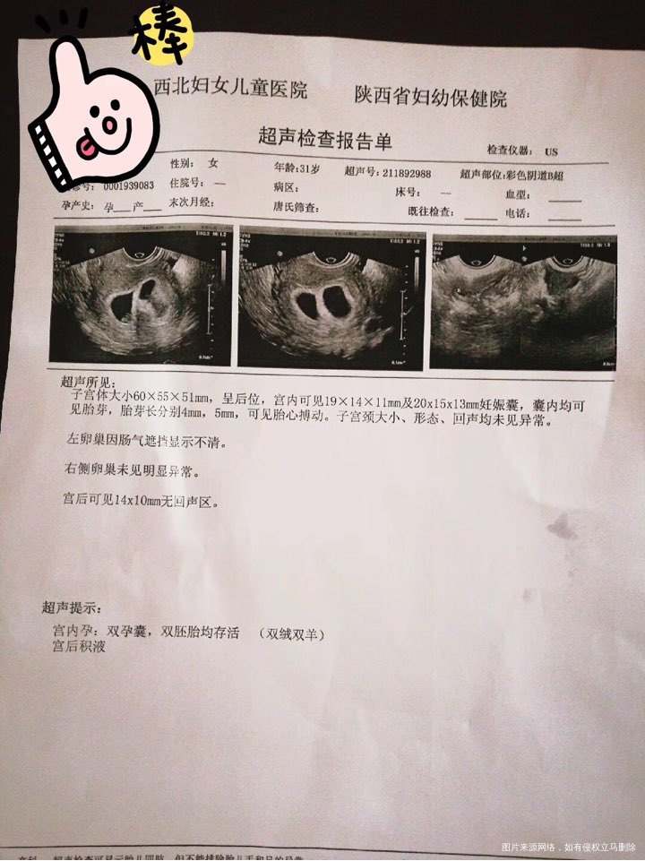 2018年11月28号,孕45天B超双胎,有喜有悲,喜的是我两个宝宝都成了,悲的...