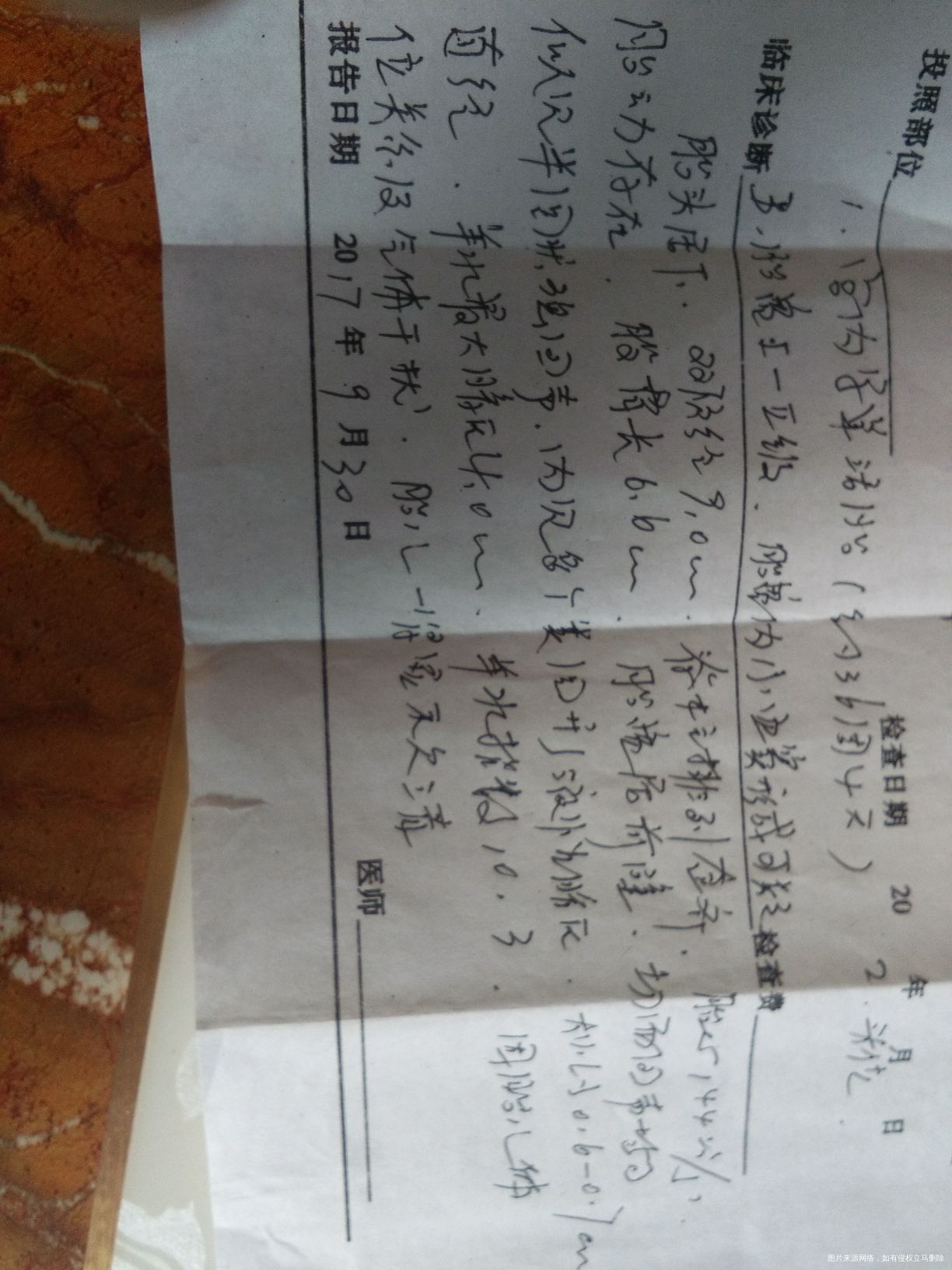 怀孕36+5,做B超发现胎盘内小血窦形成,是咋回事