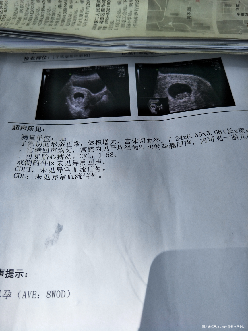 做的彩超,请医生帮忙看看
