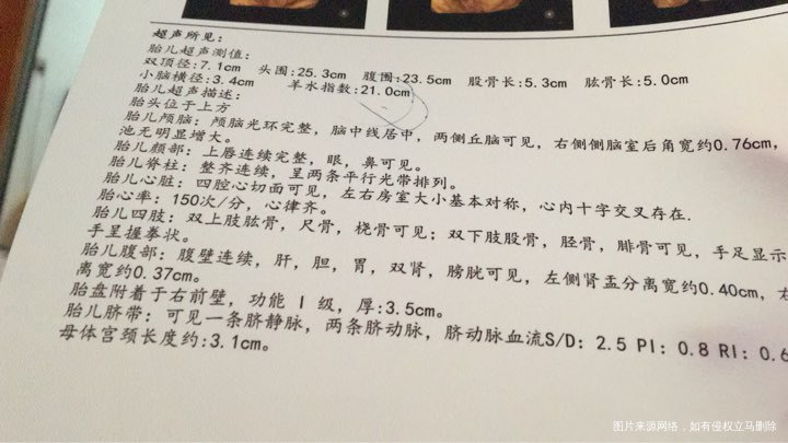 羊水多怎么,求求帮帮我想想办法