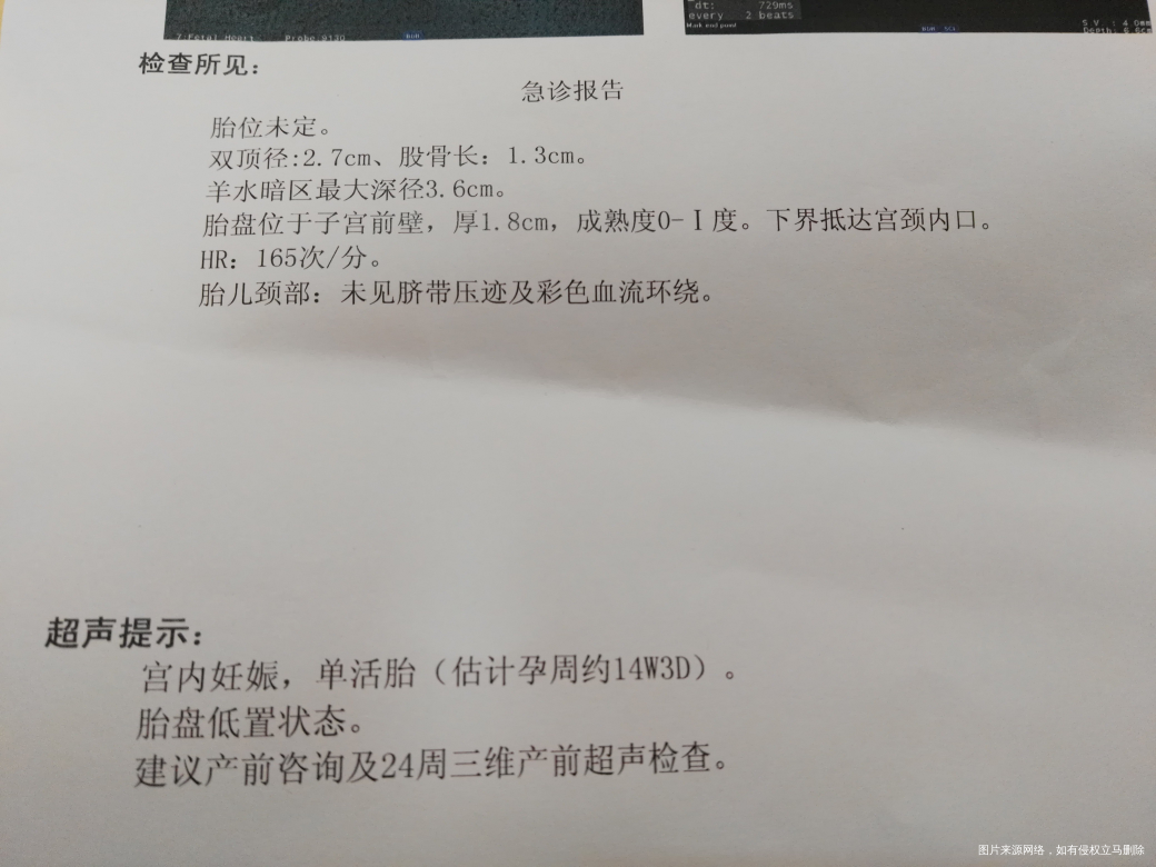 求助:孕14周B超结果