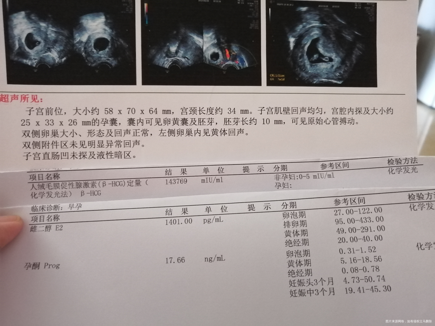 孕酮低,不想吃药,有没有什么方法?