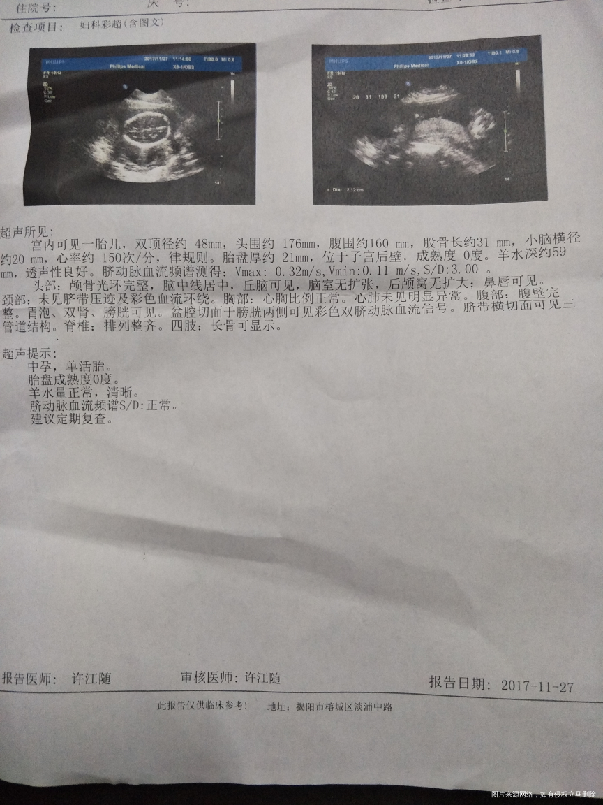 麻烦医生看看宝宝怎么样,会不会严重偏小。