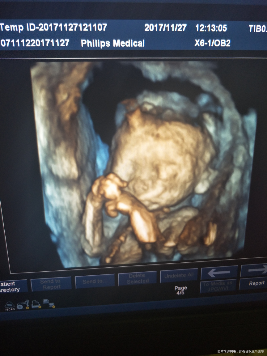 麻烦医生看看宝宝怎么样,会不会严重偏小。