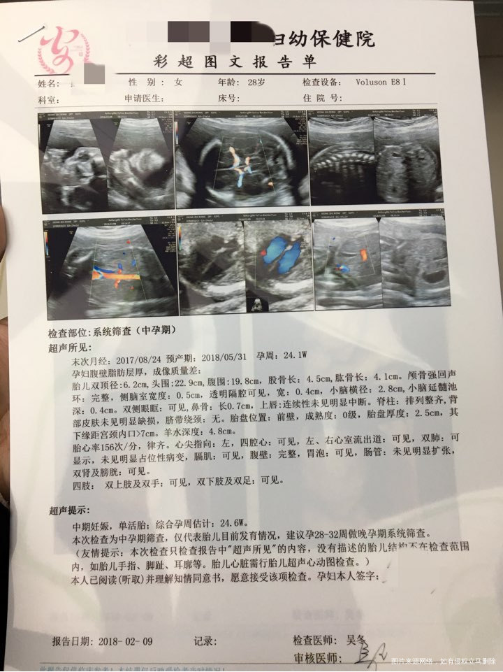 最近才做的四维,请医生帮我看看一切都正常吗?胎儿大小咋样?