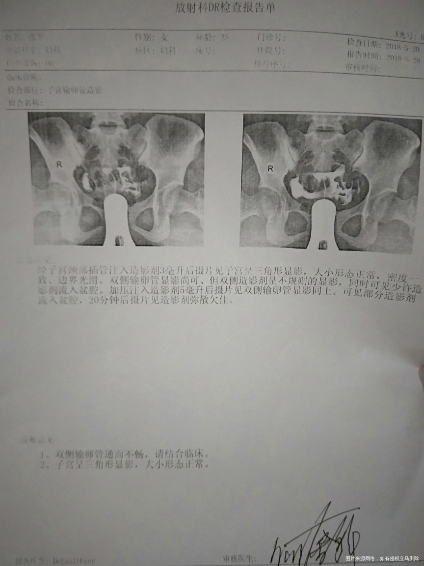 今天去医院做了造影 请帮忙看看