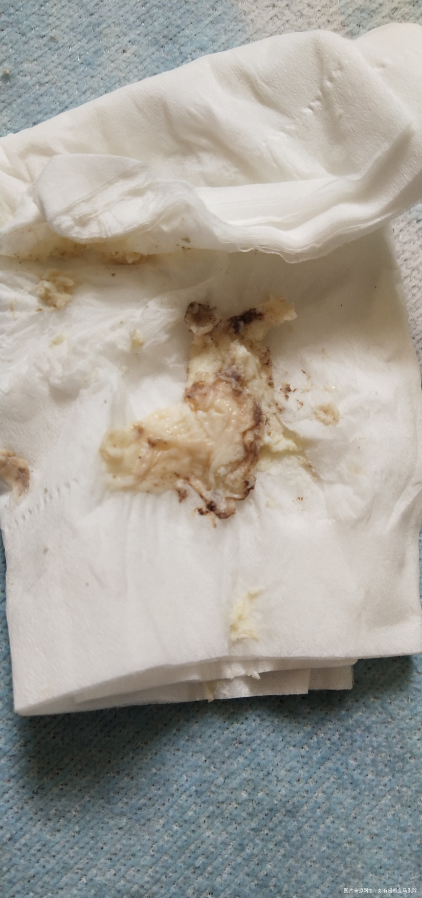 有三年没来这里了,之前移植六次都没有着床失败了,心灰意冷之下找了工作干了两年多,...