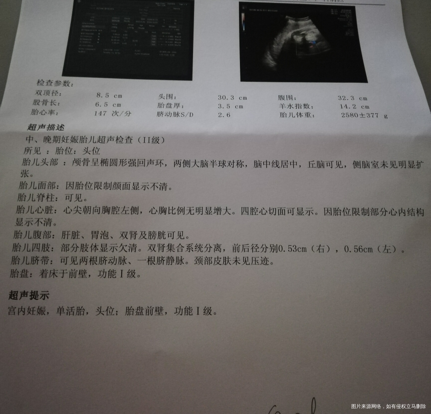 有会看男女的吗?好奇。这是33+4照的B超