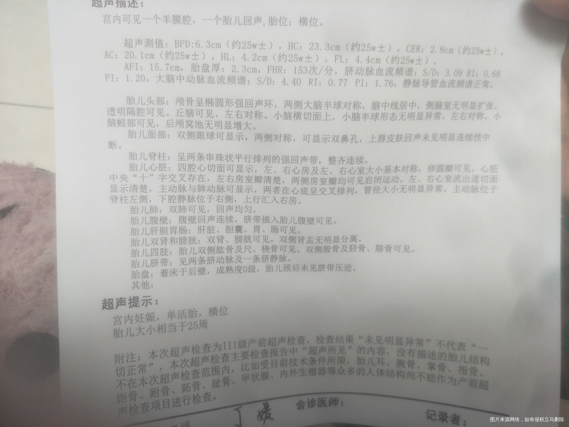今天做四维没挂上号麻烦医生帮我看看