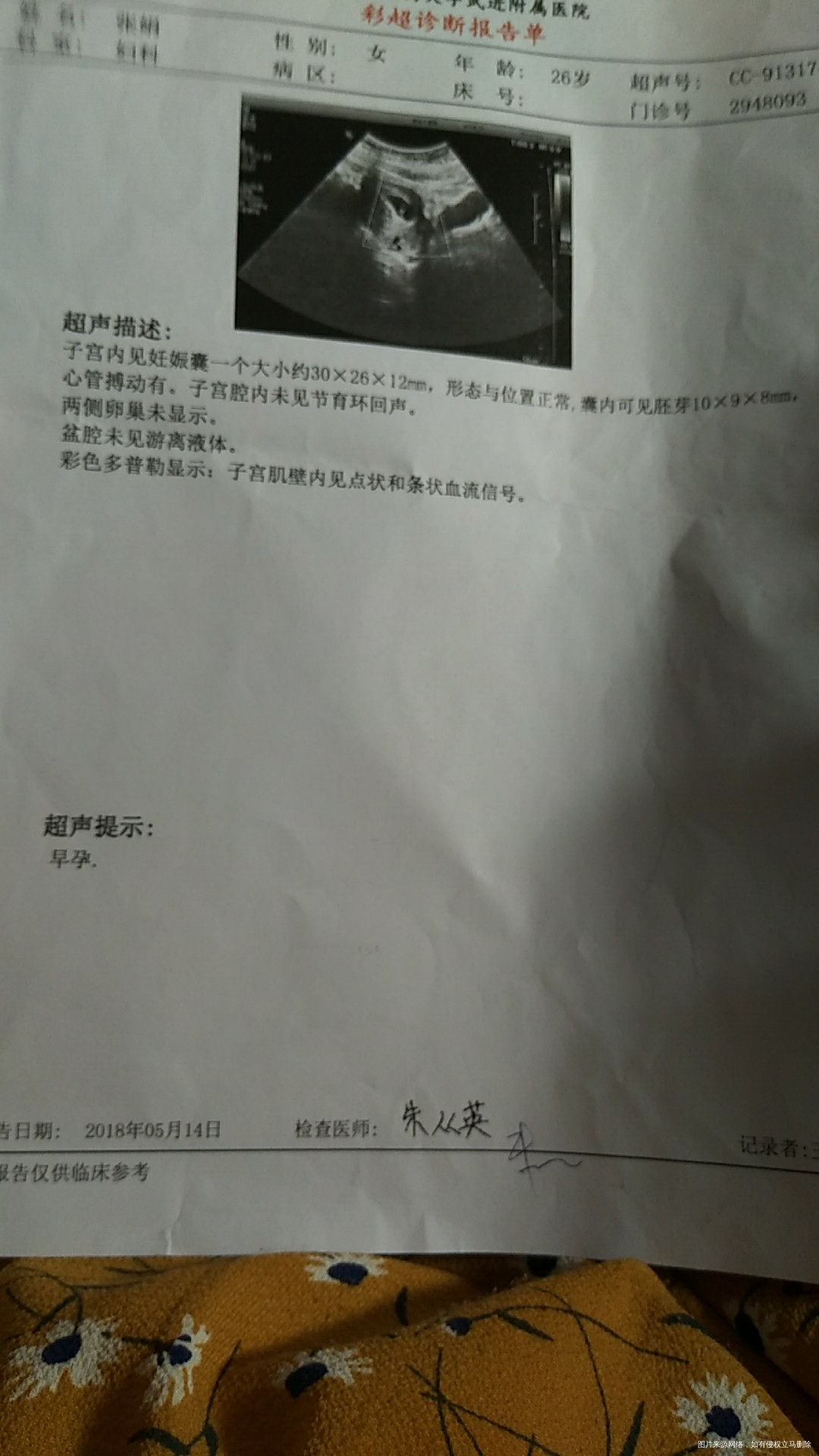 这是今天的检查,吃药可以吗?