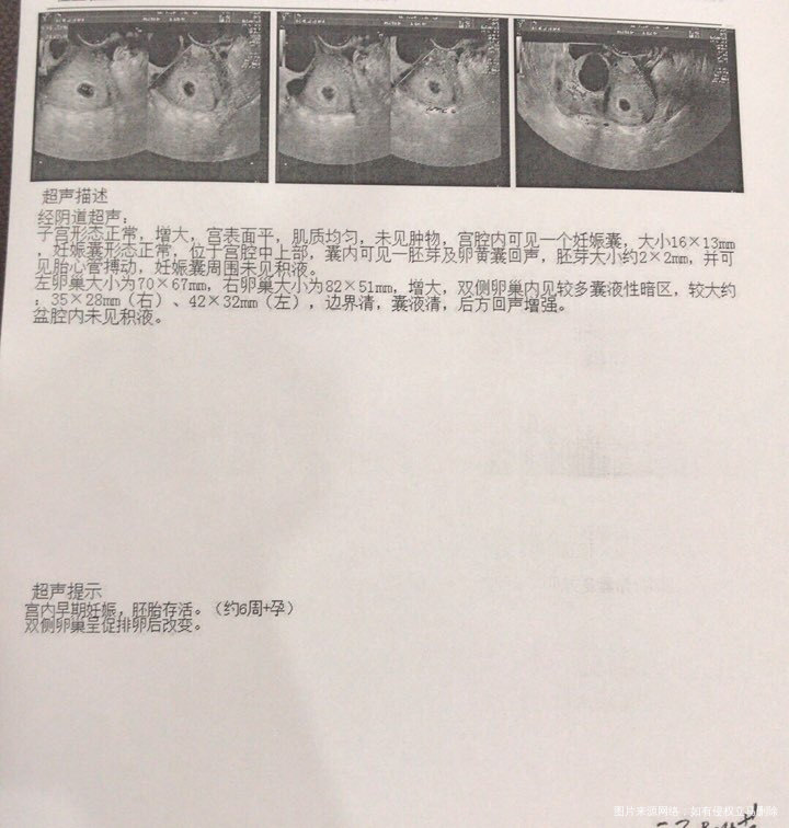 接好孕啦!!!
10月21放的鲜胚2枚,31号查的怀孕,当时第十天血值41.67…