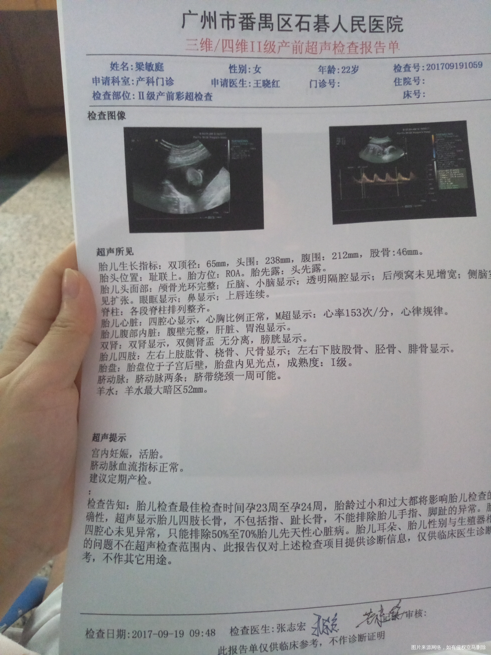 医生帮忙看看三维,好紧张啊