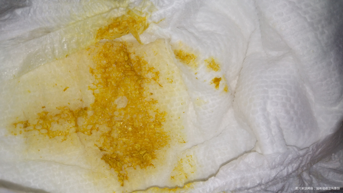 宝宝40天了,昨晚有突发状况