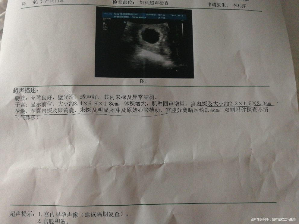 末次月经7月20日,9月13日去查B超,