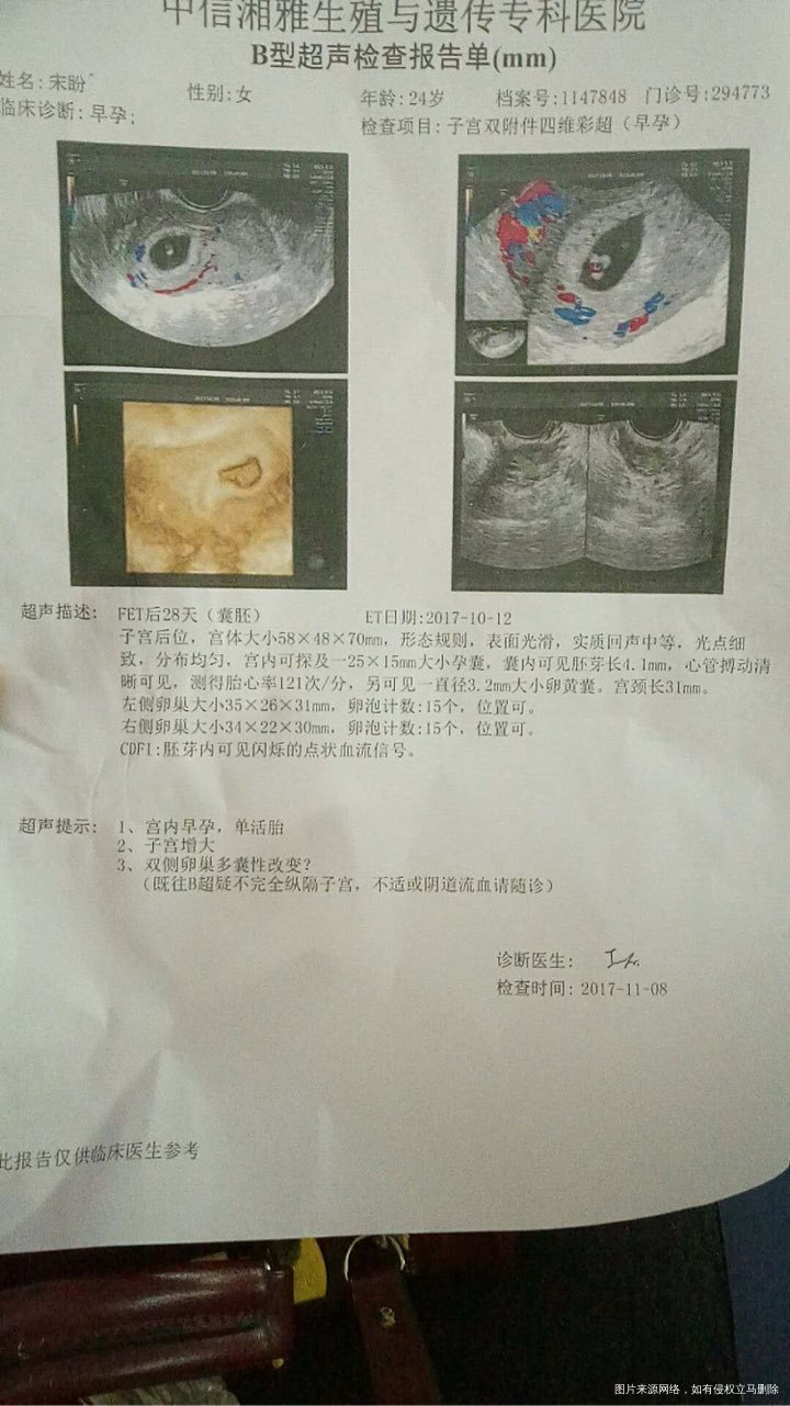 麻烦看下,为什么会这样