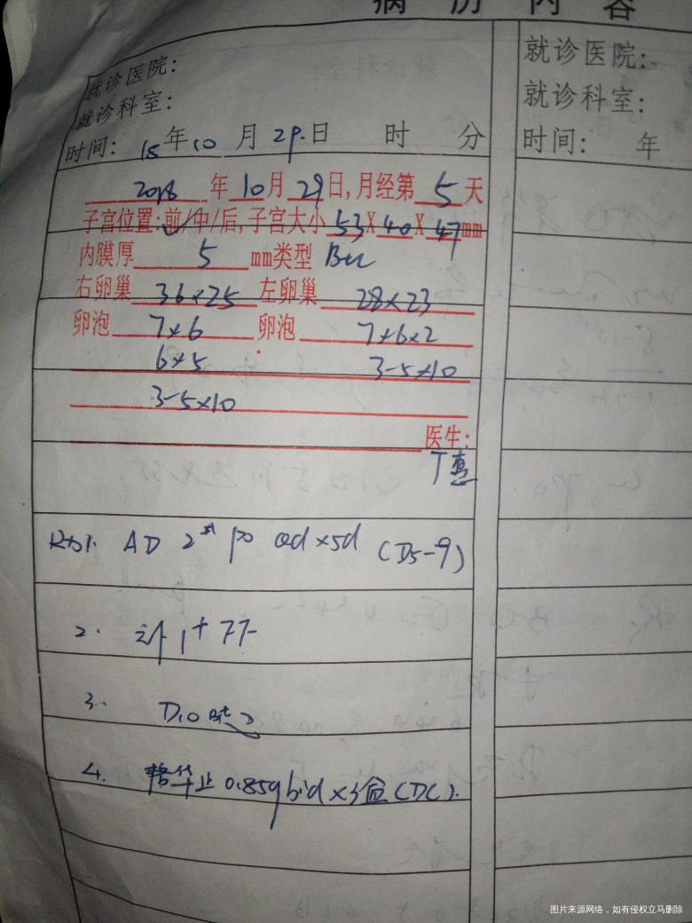 多囊 促排中 第十天没优势卵泡正常吗