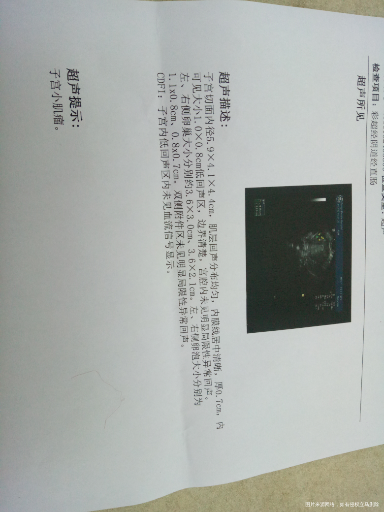 有没有妹子打过尿促后 卵泡不长的呢