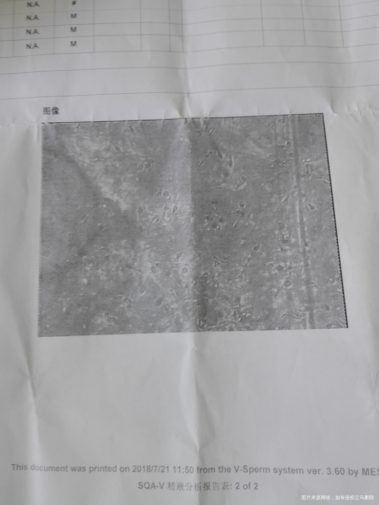 卵巢功能不好,男精子质量活力不好,医生建议试管,怎么办