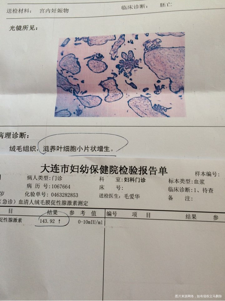 这个是“葡萄胎”。 急求助 急急急,能详细说明一下吗,拜托🙏