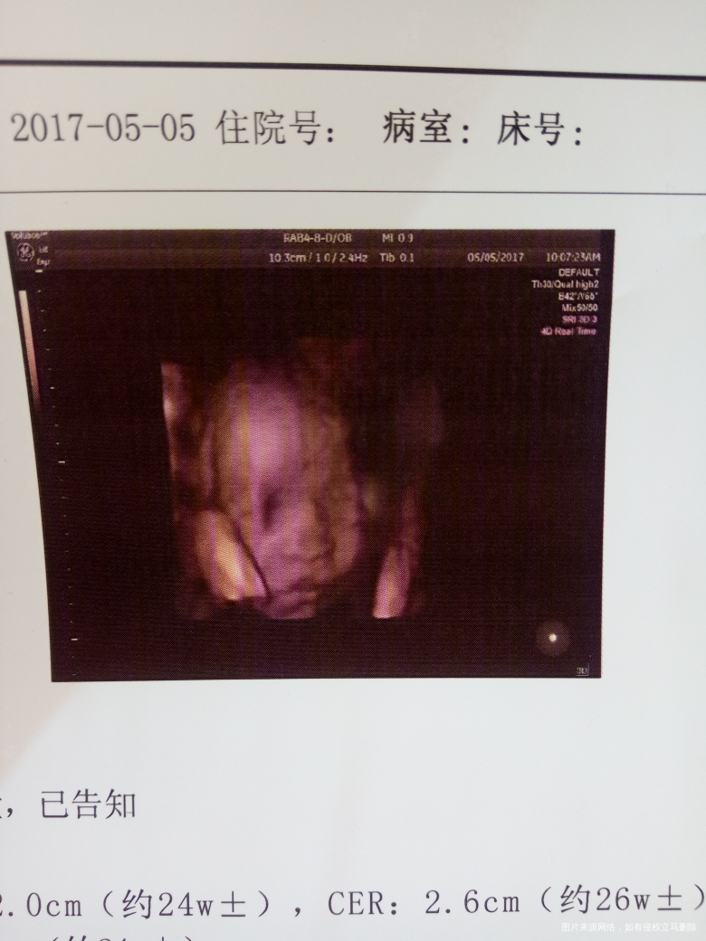 〖写给还未出的宝宝小米〗第一封信