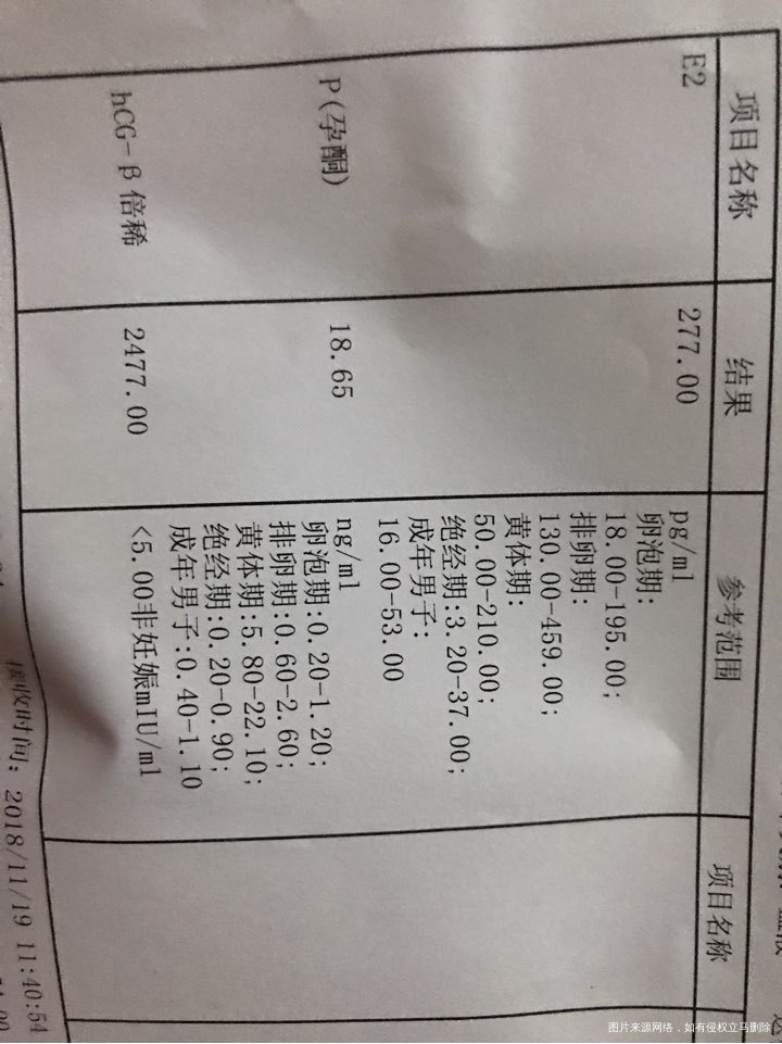 帮我看一下我的单子,谢谢