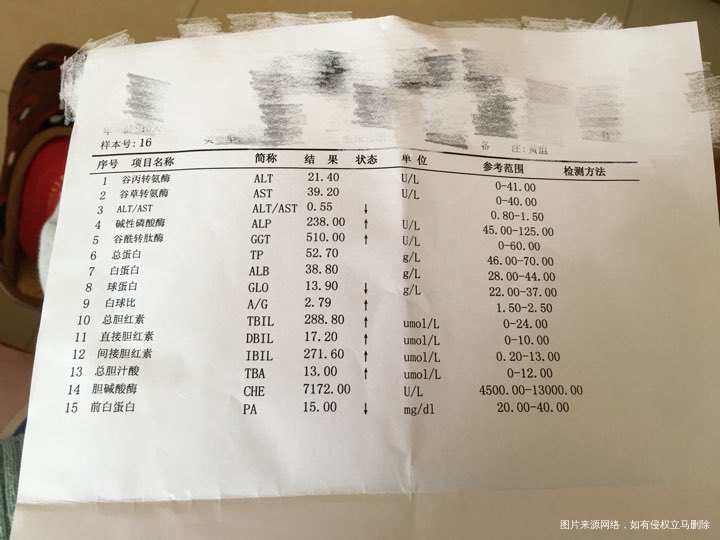 新生儿黄疸问题,附带报告。