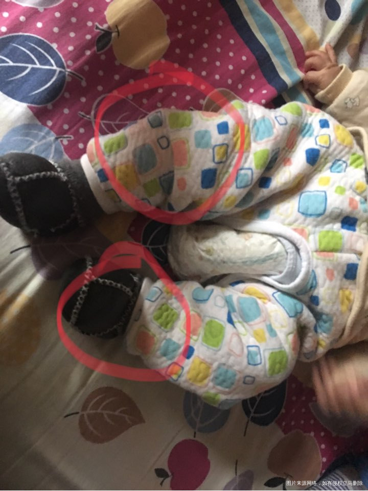 有医生在吗?咨询3个多月宝宝的问题。