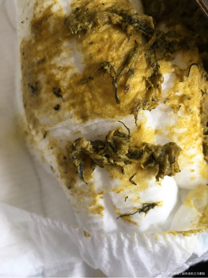 医生在吗?宝宝8个月了