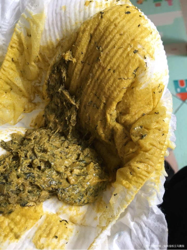 医生在吗?宝宝8个月了