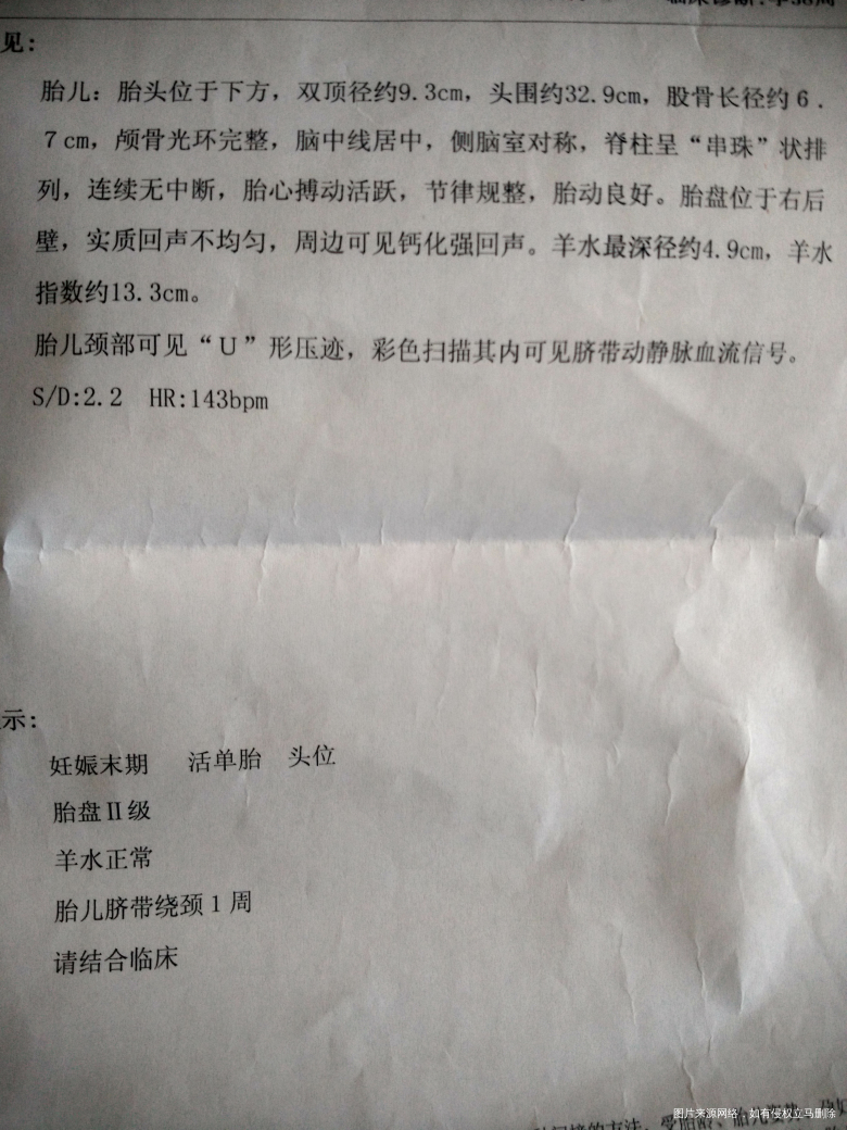 孕晚期产检看看胎儿多大,能生吗