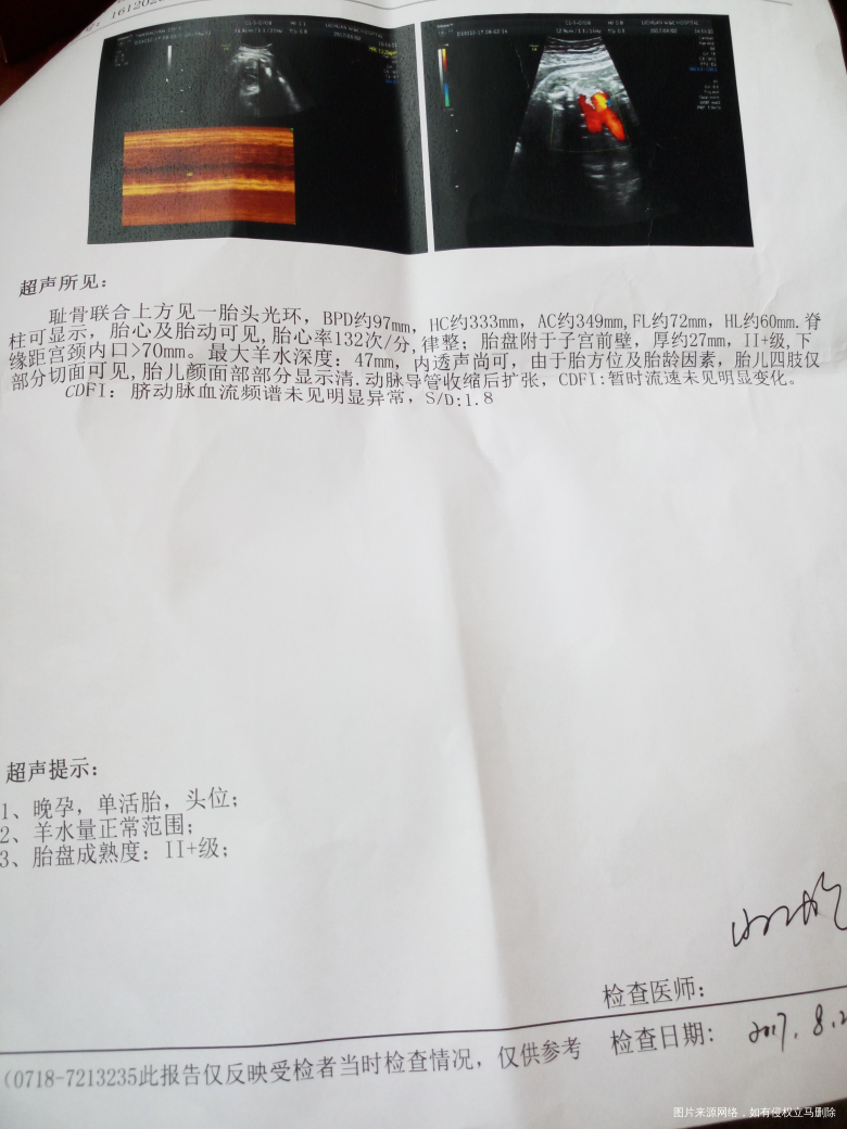 在线医生帮我看看检查结果