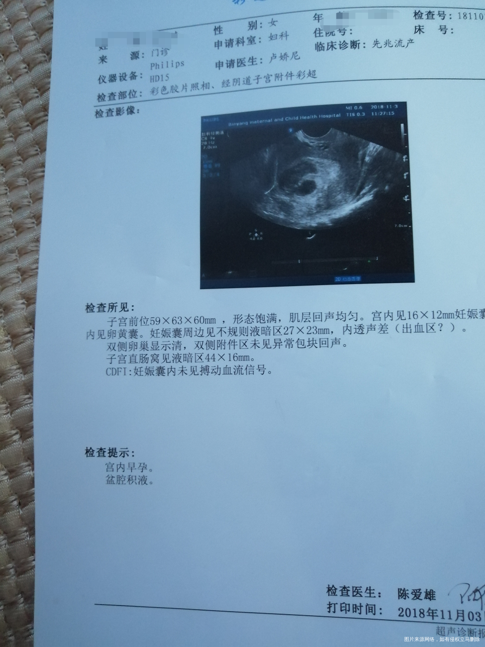 孕早期,有盆腔积液,并且出血,严重吗