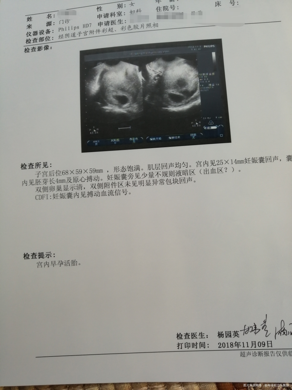 一周过去还有宫腔积液,怎么办