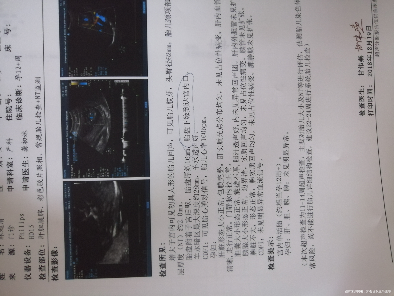 医生说B超结果不好,好担心