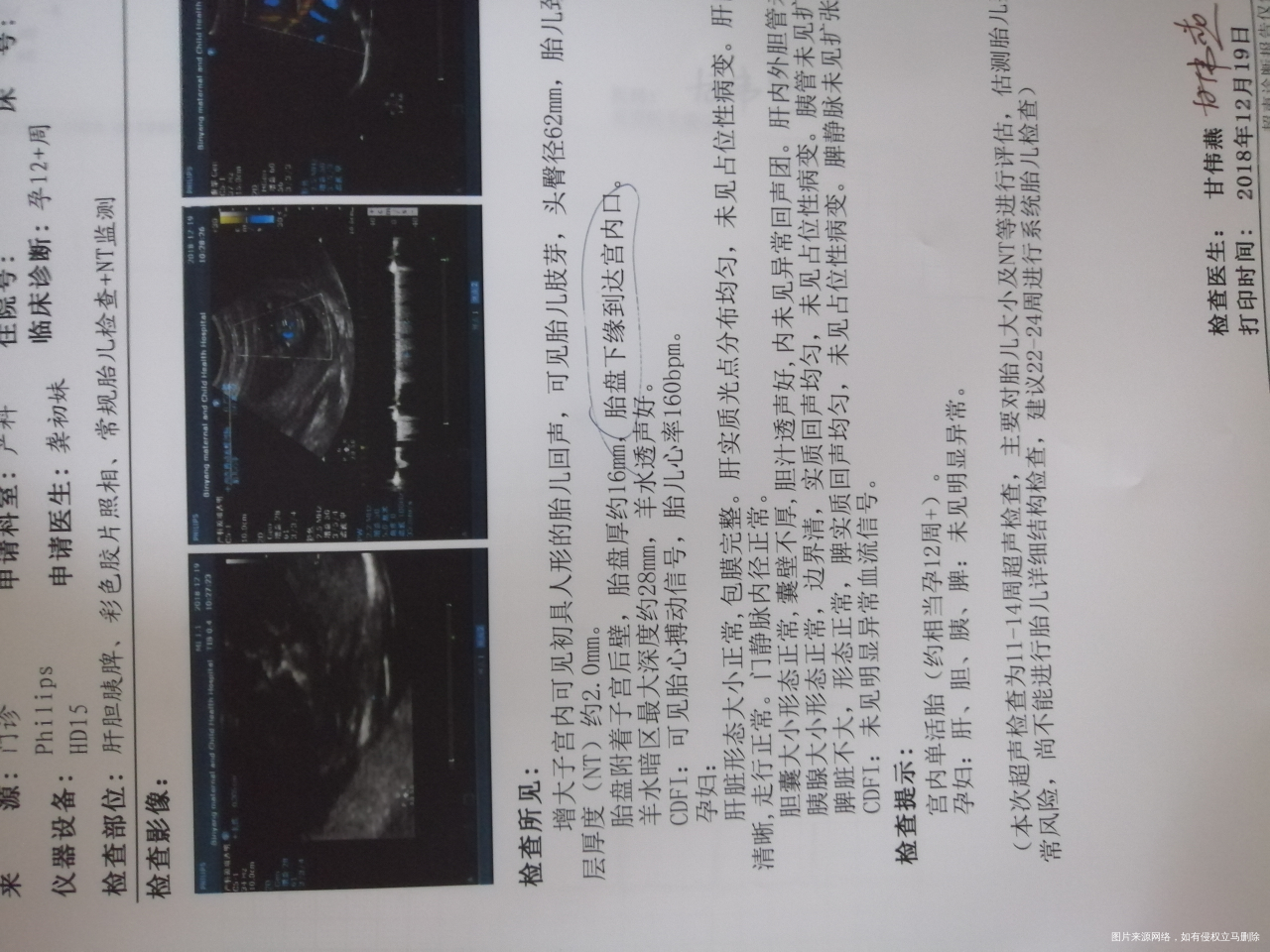 医生说B超结果不好,好担心