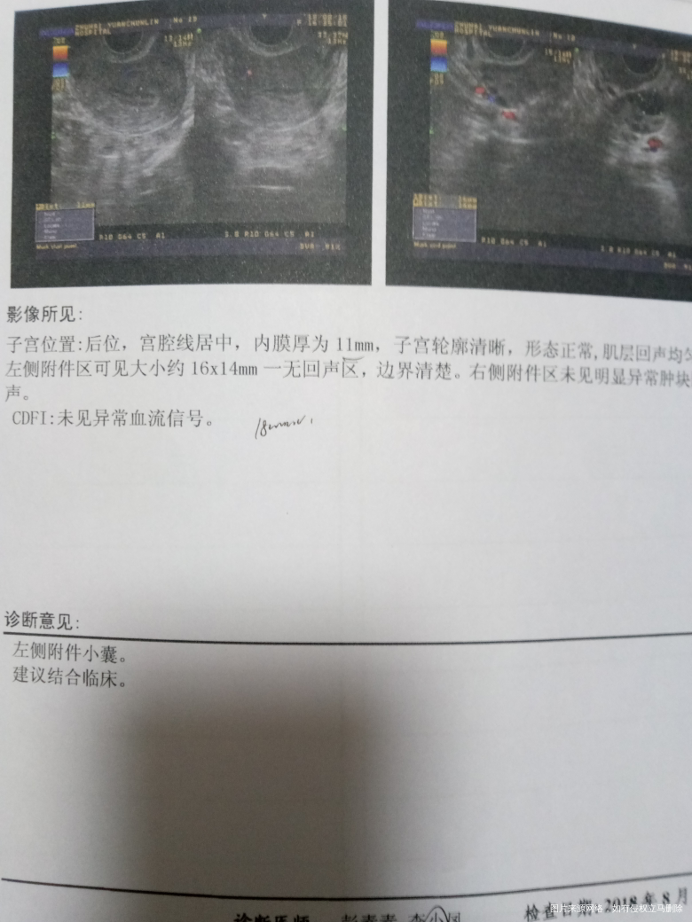 医生,我的内膜怎么又薄了呢?