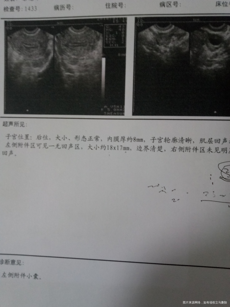 医生,我的内膜怎么又薄了呢?