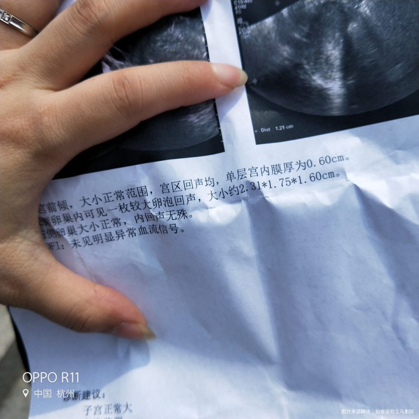5.8末次月经到5.25号去医院检测卵泡