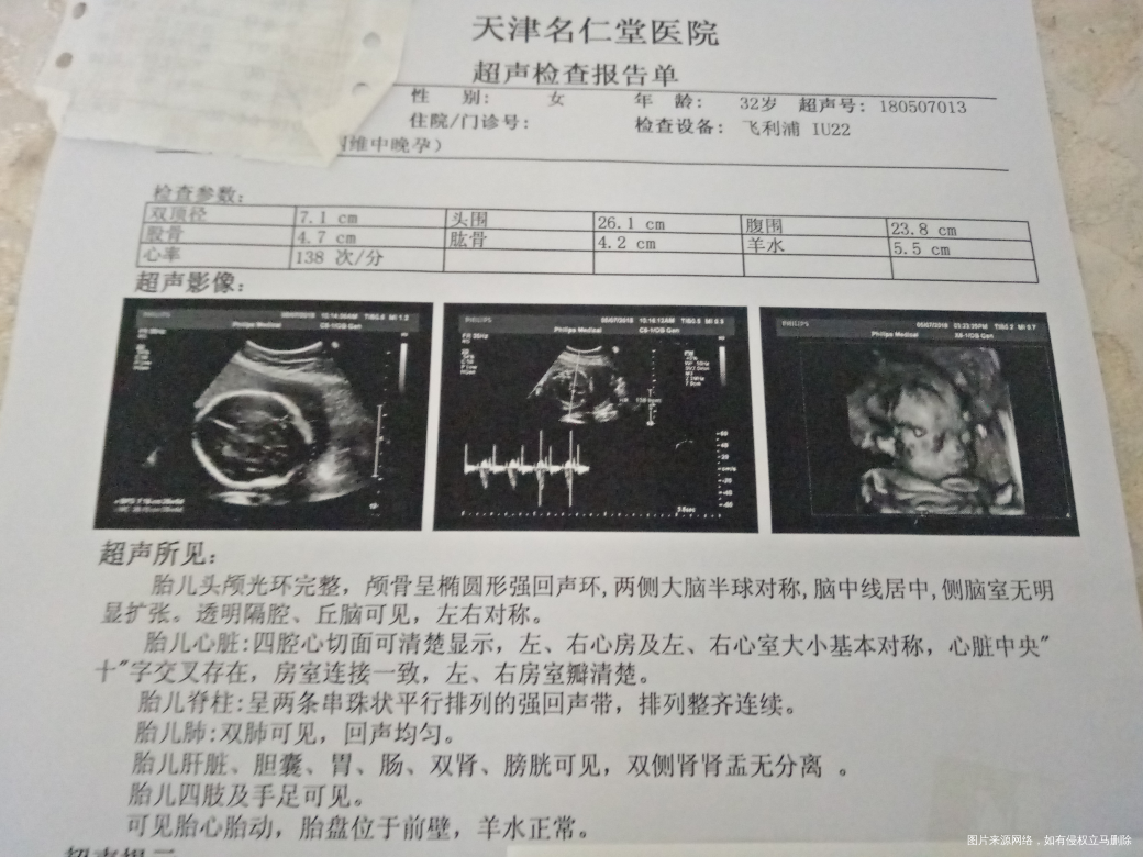 求助医生帮忙看一下四维图