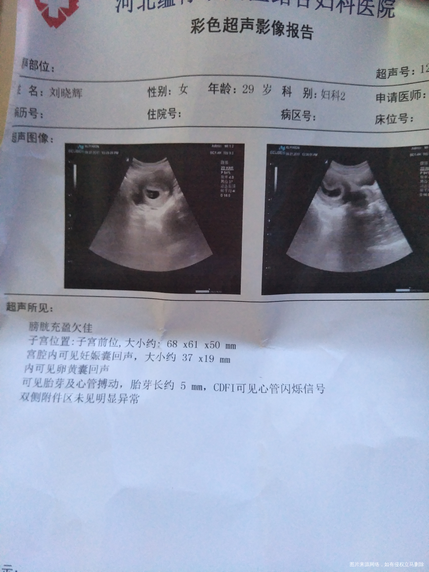 求求医生帮我看下,求求了