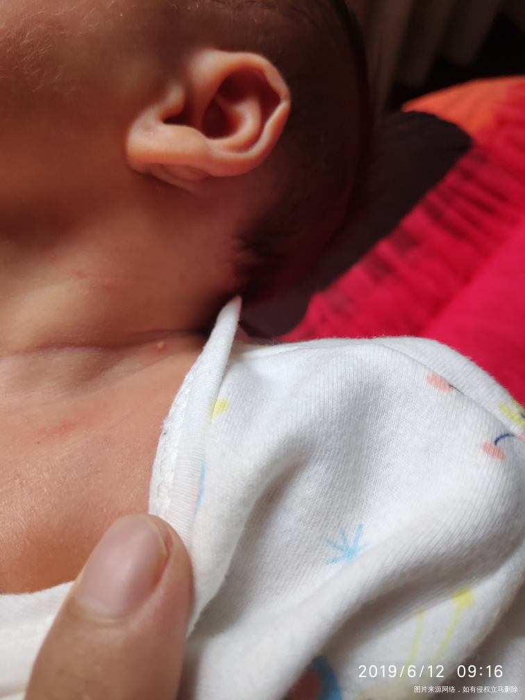 请问医师们,我宝宝今天出生14天,每天都