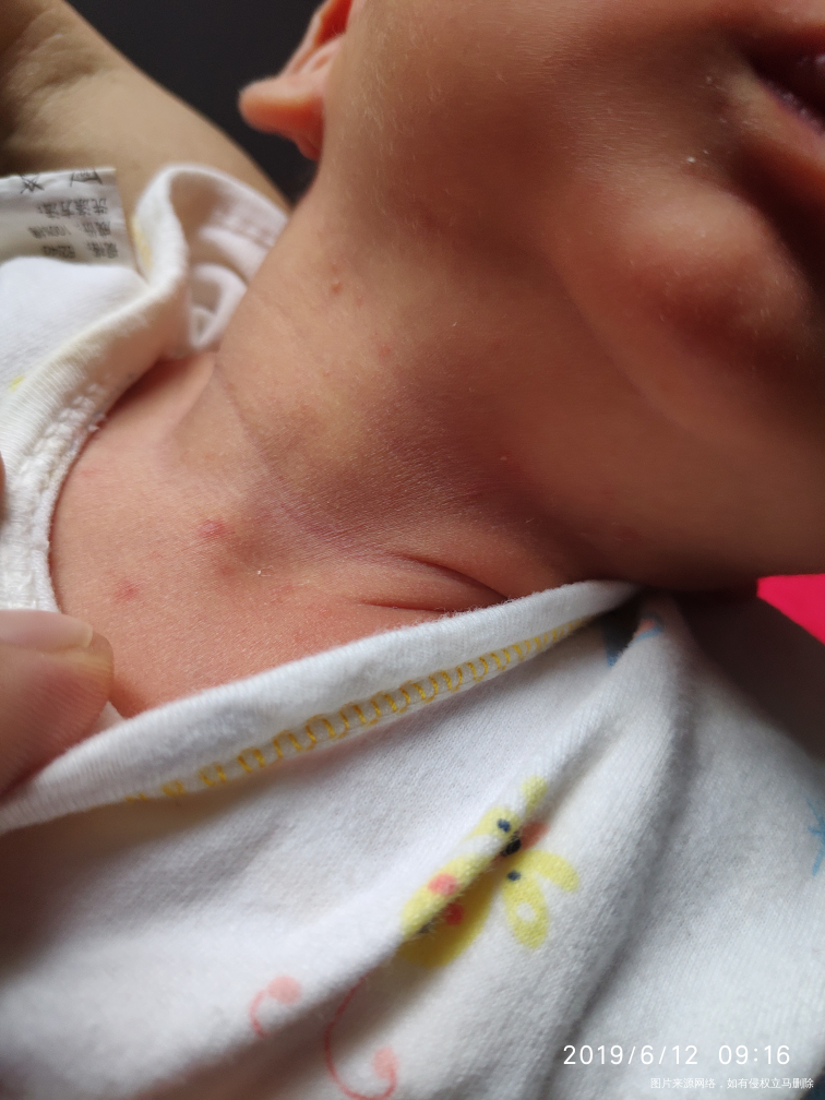 请问医师们,我宝宝今天出生14天,每天都