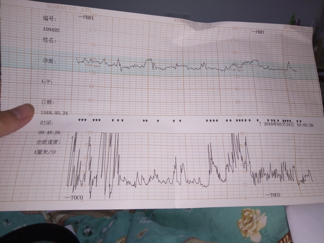 医生帮忙看一下胎心监护有宫缩吗?