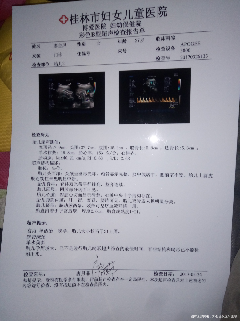 帮忙看下单,宝宝多大,有问题吗?