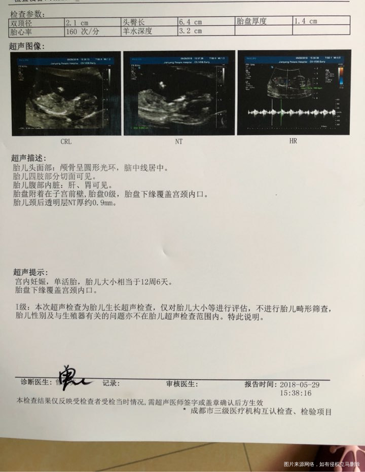 今天刚好12周,NT秒过啦!