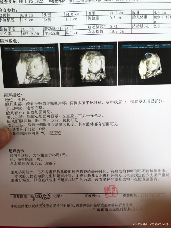 请医生帮我看看孕24周+3的四维彩超,