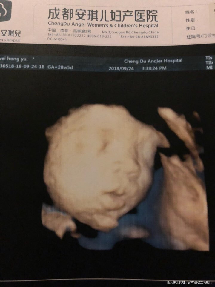 孕28+5。双顶径8.3