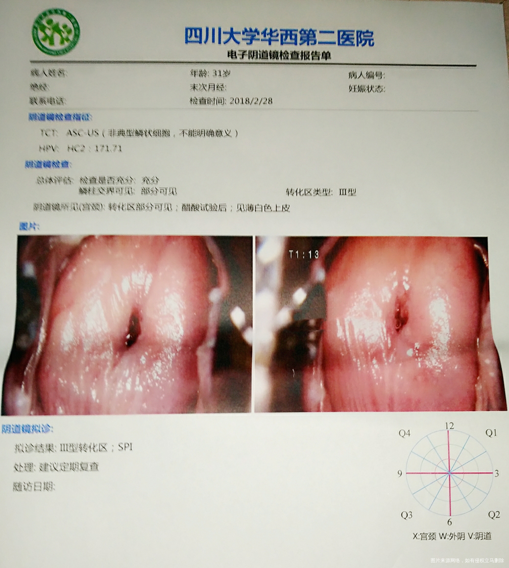 急求医生看下报告,谢谢!