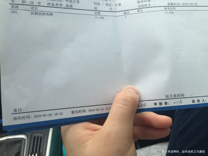 抗核抗体阳性,怎样治疗